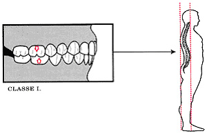 La position cervico-scapulaire