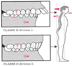 La position cervico-scapulaire