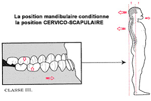 La position cervico-scapulaire