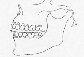Courbe de l'occlusion
